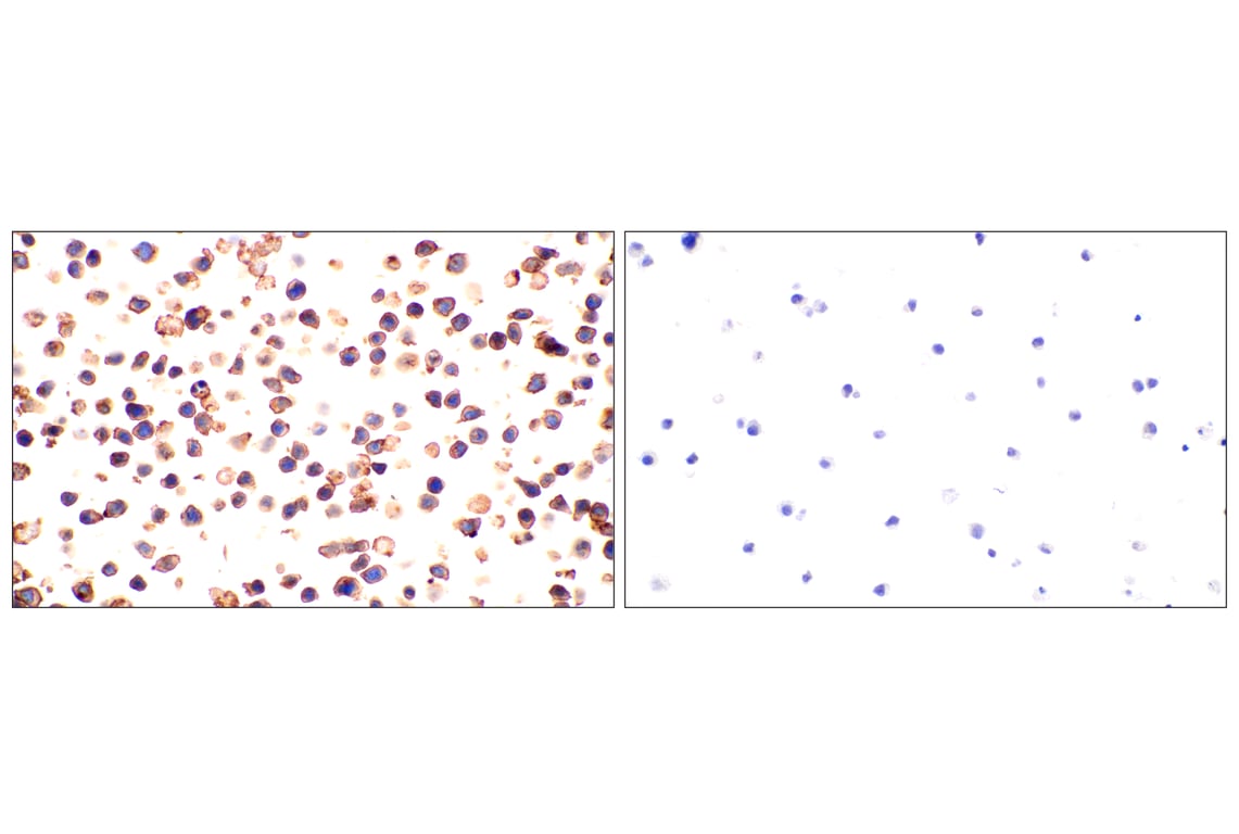 Immunohistochemistry Image 7: CD5 (E6N9S) Rabbit Monoclonal Antibody (BSA and Azide Free)
