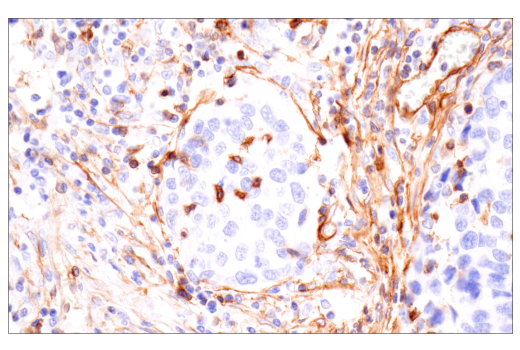Immunohistochemistry Image 7: Integrin alpha1/CD49a (E9K2J) Rabbit Monoclonal Antibody (BSA and Azide Free)
