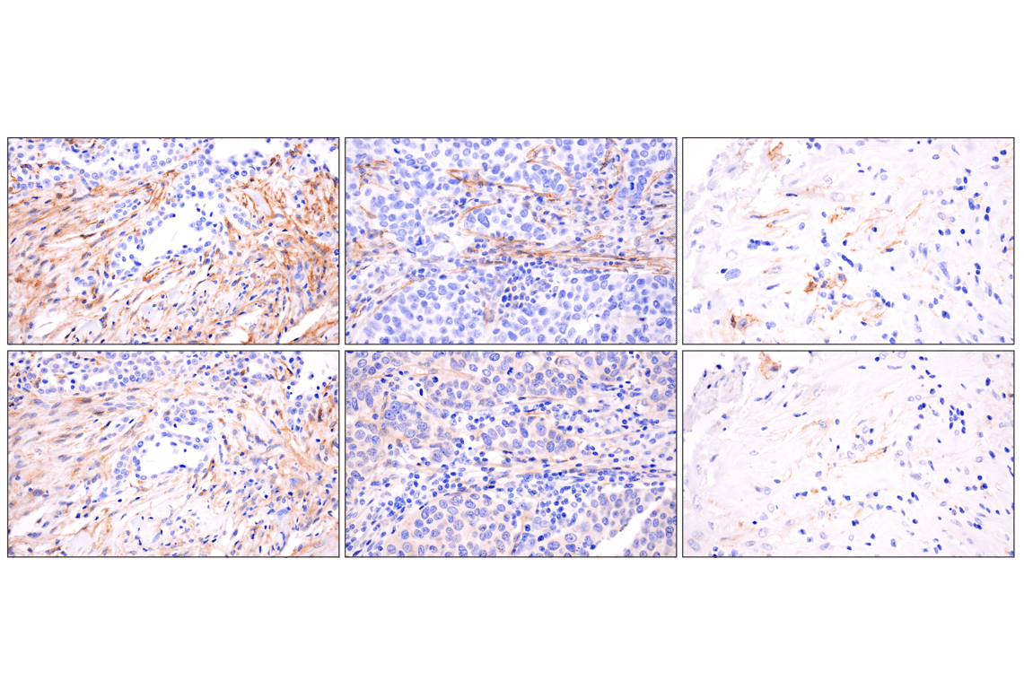 Immunohistochemistry Image 9: LRRC15 (E4X8J) Rabbit Monoclonal Antibody