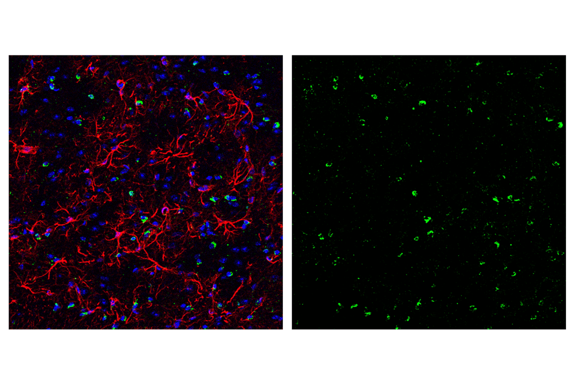Immunofluorescence Image 6: Smac/Diablo (D5S3R) Rabbit Monoclonal Antibody