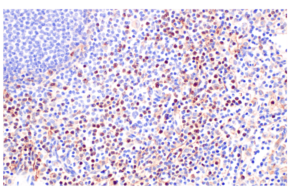 Immunohistochemistry Image 5: VISTA (D1L2G<sup>™</sup>) Rabbit Monoclonal Antibody (BSA and Azide Free)