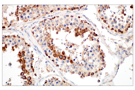Immunohistochemistry Image 9: TFAM (D5C8) Rabbit Monoclonal Antibody