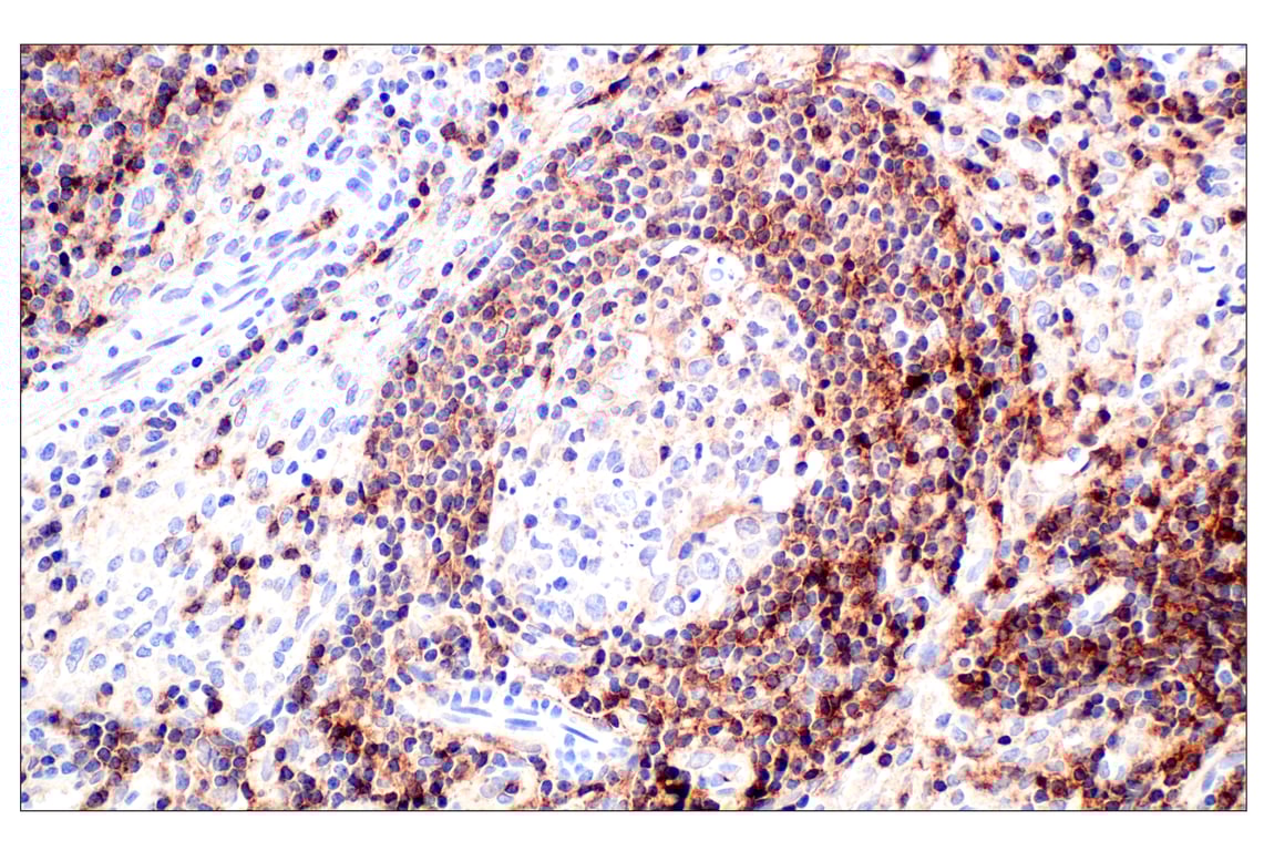 Immunohistochemistry Image 7: CD62L/L-Selectin (E7X9I) Rabbit Monoclonal Antibody