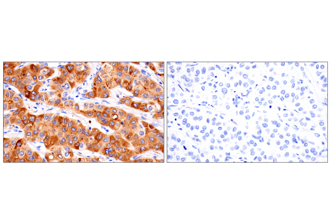 Immunohistochemistry Image 14: Vitronectin (F8D3L) Rabbit Monoclonal Antibody