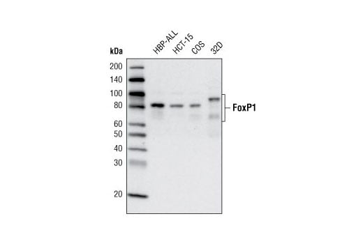 Western Blotting Image 1: FoxP1 (D35D10) XP<sup>®</sup> Rabbit mAb