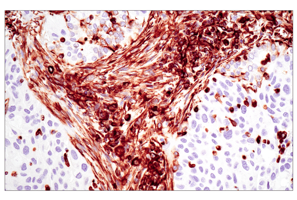 Immunohistochemistry Image 1: Vimentin (D21H3) Rabbit Monoclonal Antibody