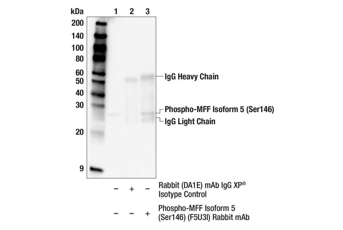 Immunoprecipitation Image 1: Phospho-MFF Isoform 5 (Ser146) (F5U3I) Rabbit Monoclonal Antibody