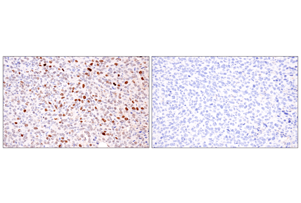 Immunohistochemistry Image 6: Phospho-Histone H2A.X (Ser139) (D7T2V) Mouse Monoclonal Antibody
