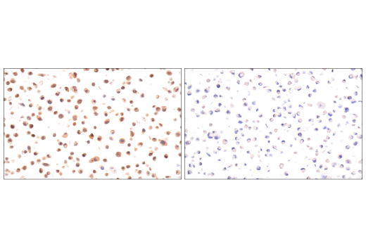 Immunohistochemistry Image 13: VHL (E3X9K) Rabbit Monoclonal Antibody