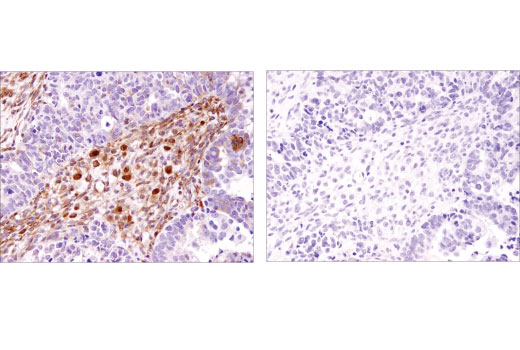 Immunohistochemistry Image 5: FoxO1 (D8T1S) Mouse Monoclonal Antibody