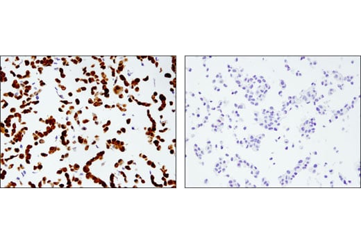 Immunohistochemistry Image 2: UCHL1 (D3T2E) Rabbit Monoclonal Antibody