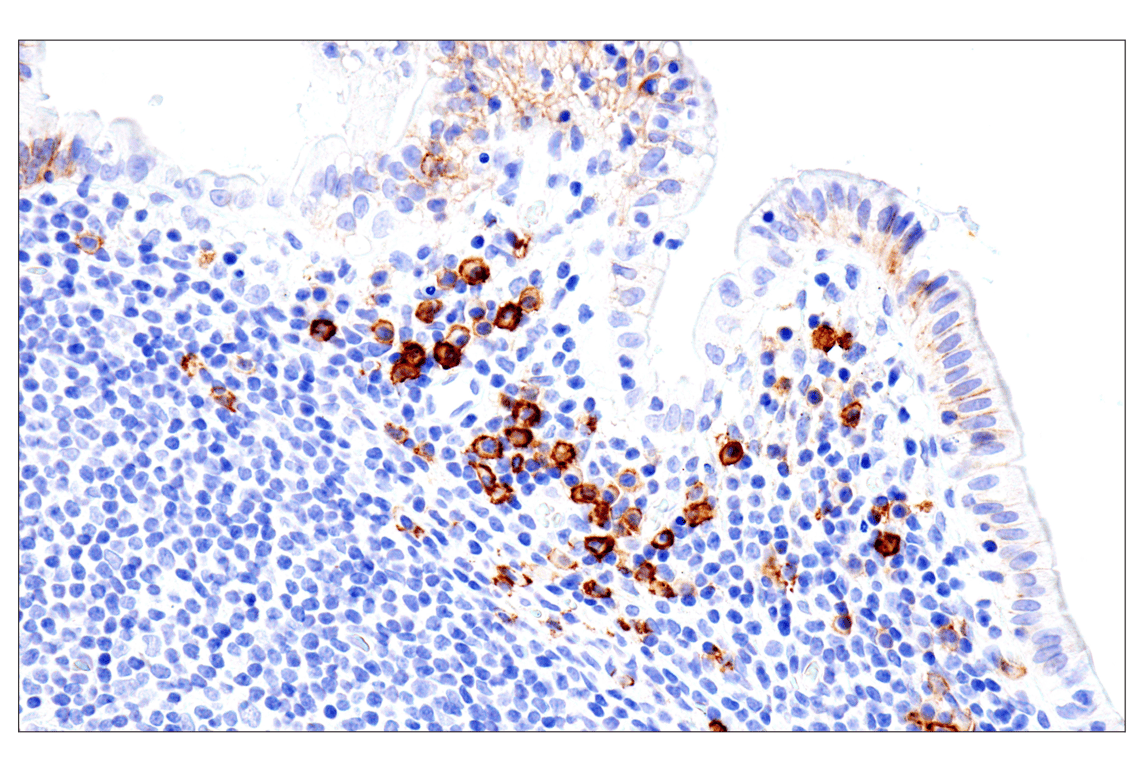 Immunohistochemistry Image 10: Syndecan 1 (E7F7T) Rabbit Monoclonal Antibody