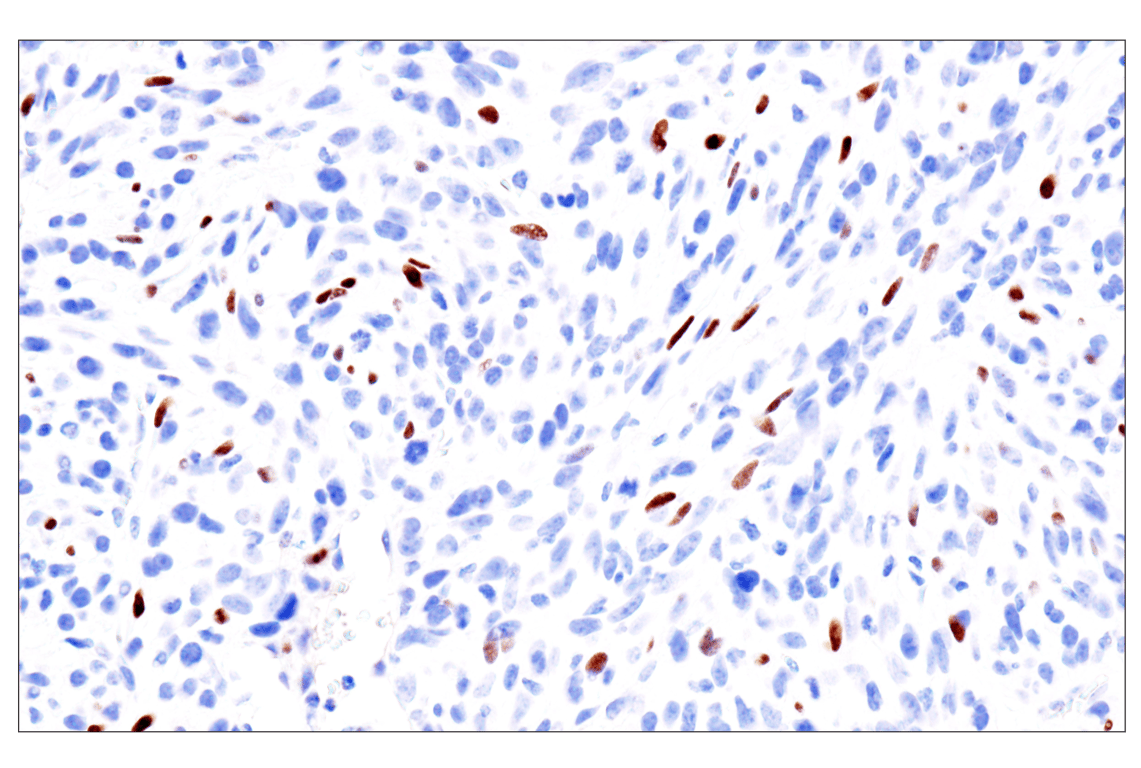Immunohistochemistry Image 17: GATA-6 (D61E4) Rabbit Monoclonal Antibody