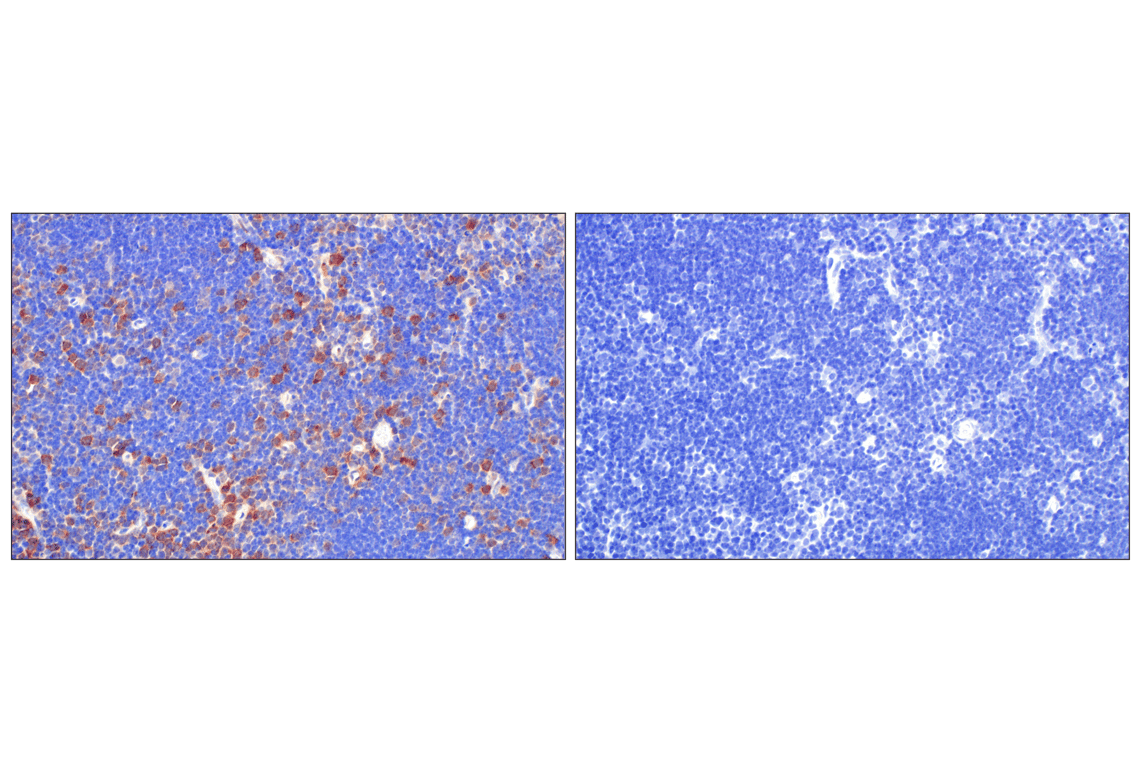 Immunohistochemistry Image 3: CDK4 (F8L5F) Rabbit Monoclonal Antibody