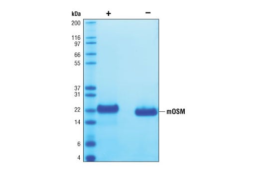 undefined Image 2: Mouse Oncostatin M (mOSM)