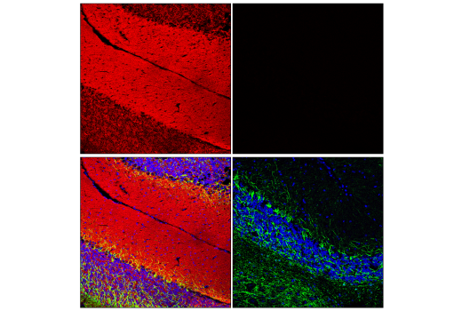 Immunofluorescence Image 1: Tau 4R (E7T4F) Rabbit Monoclonal Antibody (BSA and Azide Free)
