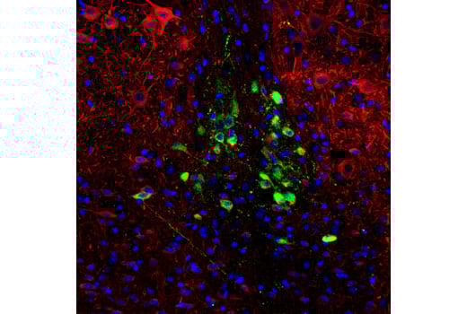Immunofluorescence Image 1: CART (D6L8J) Rabbit Monoclonal Antibody