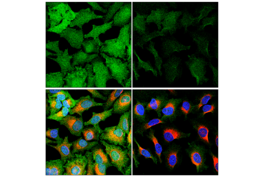 Immunofluorescence Image 1: CDK5 (D1F7M) Rabbit Monoclonal Antibody