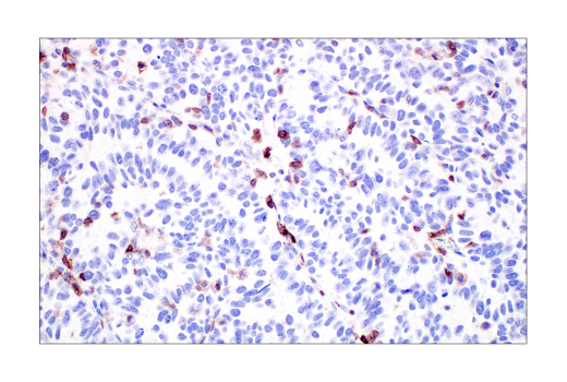 Immunohistochemistry Image 2: TIGIT (E5Y1W) Rabbit Monoclonal Antibody