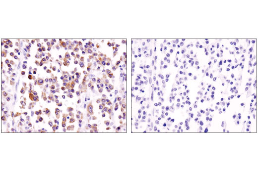 Immunohistochemistry Image 2: BLNK (D3P2H) Rabbit Monoclonal Antibody (BSA and Azide Free)