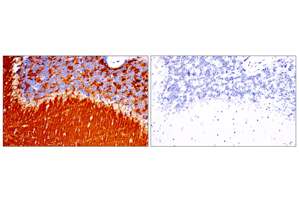 undefined Image 36: Presynaptic Vesicle Cycle Antibody Sampler Kit