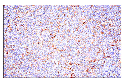 Immunohistochemistry Image 1: CD86 (E5W6H) Rabbit Monoclonal Antibody