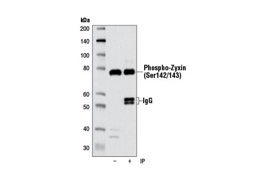 Immunoprecipitation Image 1: Phospho-Zyxin (Ser142/143) (D1E8) Rabbit Monoclonal Antibody