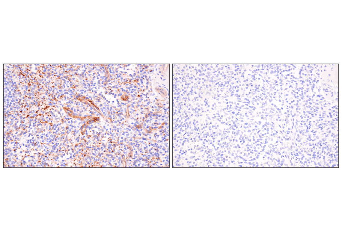 Immunohistochemistry Image 6: ESAM (F2Y5Q) Rabbit Monoclonal Antibody