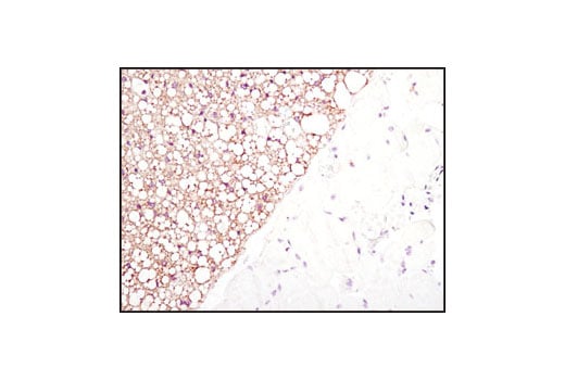 Immunohistochemistry Image 5: Fatty Acid Synthase (C20G5) Rabbit Monoclonal Antibody (BSA and Azide Free)