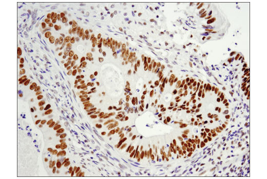 Immunohistochemistry Image 1: LRF/Pokemon (D7U2O) Rabbit Monoclonal Antibody