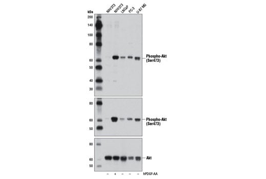 Western Blotting Image 1: Phospho-Akt (Ser473) (D9W9U) Mouse mAb