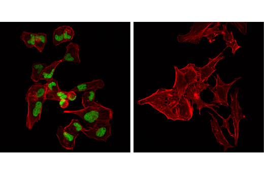 Immunofluorescence Image 1: MyoD1 (D8G3) Rabbit Monoclonal Antibody