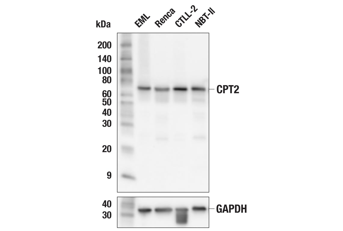 Western Blotting Image 2: CPT2 (E7D4W) Rabbit Monoclonal Antibody