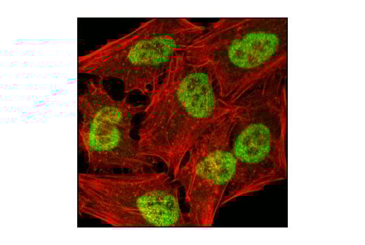 Immunofluorescence Image 1: JMJD1B (C69G2) Rabbit Monoclonal Antibody