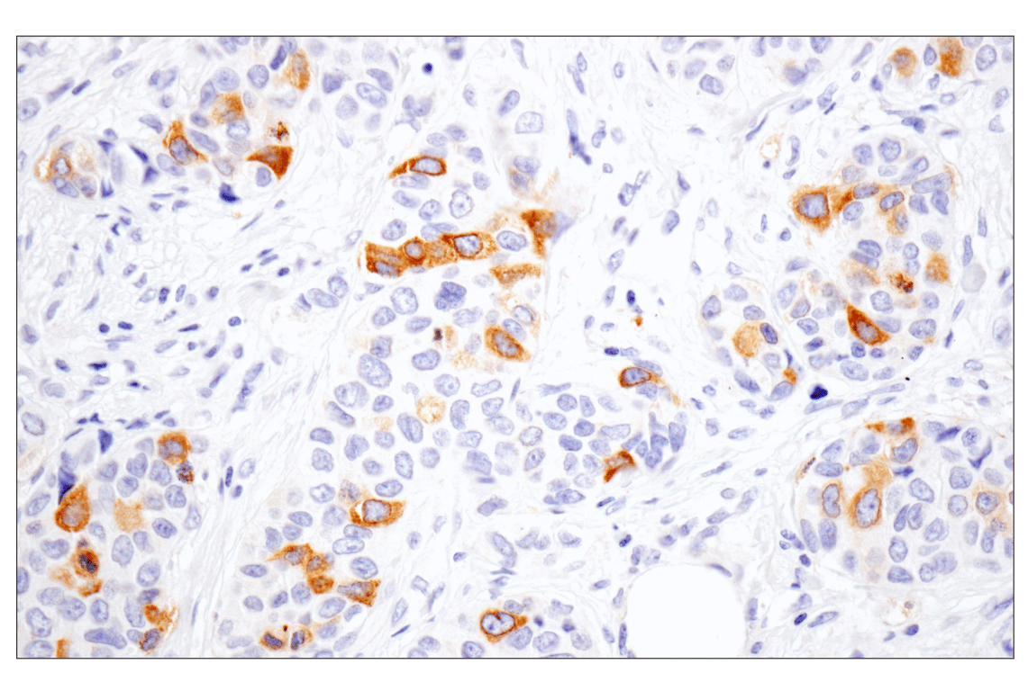 Immunohistochemistry Image 2: Eg5 (E1L3W) Rabbit Monoclonal Antibody
