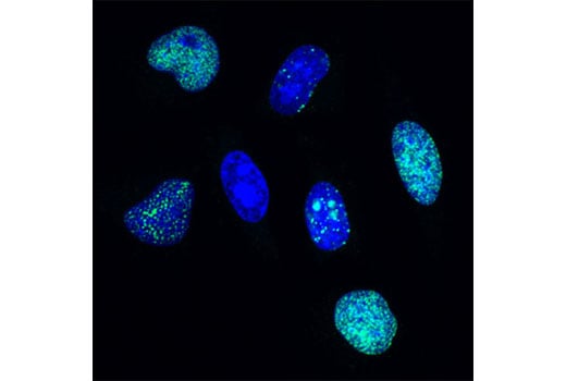 Immunofluorescence Image 1: BrdU (Bu20a) Mouse Monoclonal Antibody