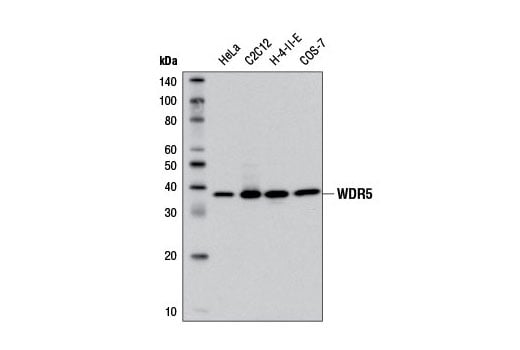 undefined Image 1: SET1/COMPASS Antibody Sampler Kit