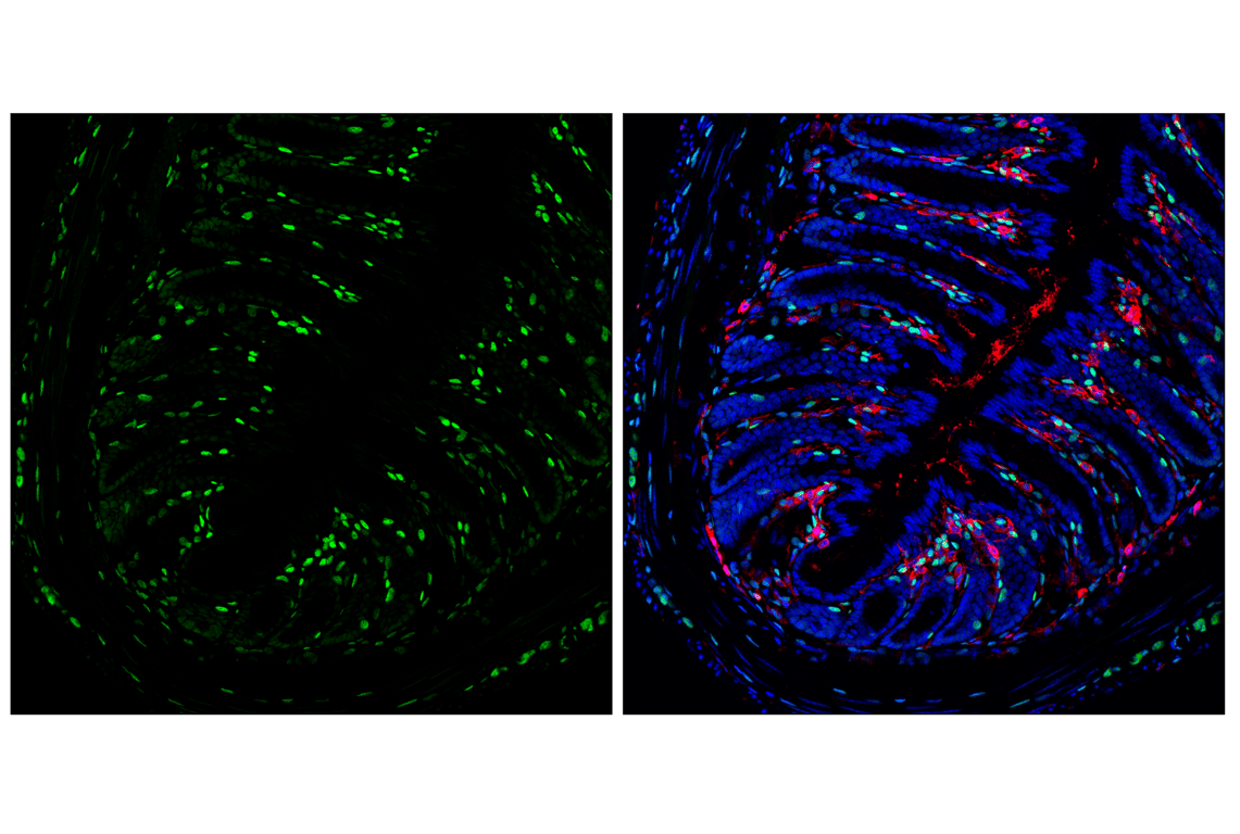 Immunofluorescence Image 1: TCF4/ITF2 (E3X2Y) Rabbit Monoclonal Antibody