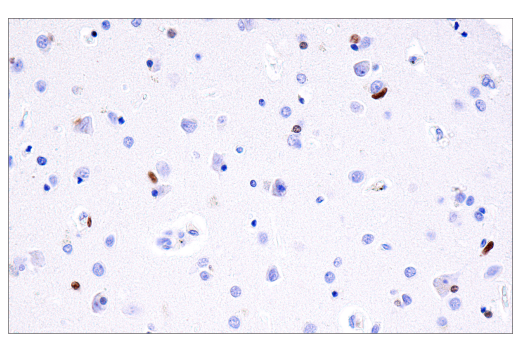 Immunohistochemistry Image 2: Olig2 (E6G6Q) Rabbit Monoclonal Antibody (BSA and Azide Free)