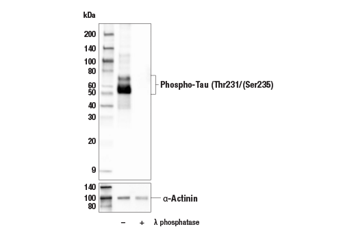 Western Blotting Image 2: Phospho-Tau (Thr231/Ser235) (E7G5W) Rabbit Monoclonal Antibody