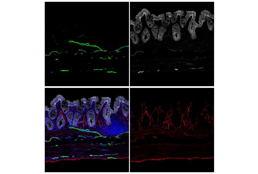 その他 user_07f11068 LYVE-1 (E3L3V) Rabbit mAb | Cell Signaling Technology