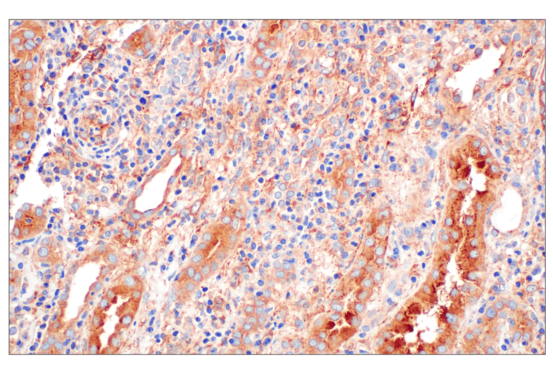 Immunohistochemistry Image 4: EEA1 (E9Q6G) Mouse Monoclonal Antibody