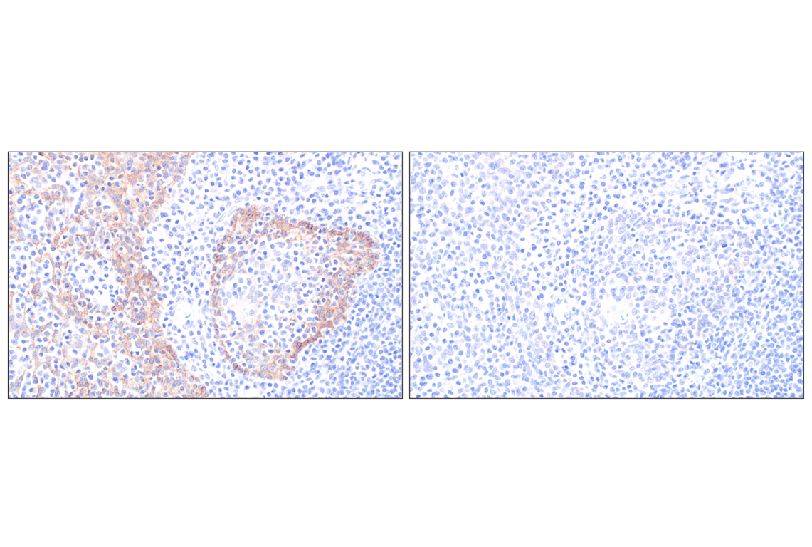 Immunohistochemistry Image 5: P-Cadherin (C13F9) Rabbit Monoclonal Antibody