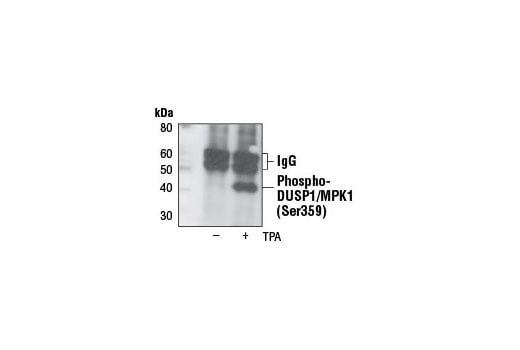 Immunoprecipitation Image 1: Phospho-DUSP1/MKP1 (Ser359) (125E2) Rabbit Monoclonal Antibody
