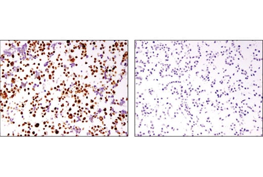 Immunohistochemistry Image 3: MSH6 (3E1) Mouse Monoclonal Antibody