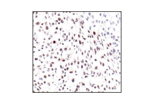 Immunohistochemistry Image 1: Phospho-ATF-2 (Thr71) Antibody