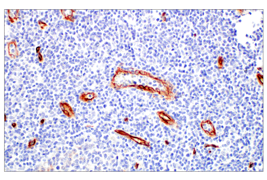 Immunohistochemistry Image 11: Nestin (E4O9E) Rabbit Monoclonal Antibody