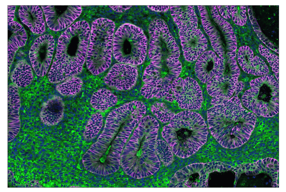 Immunohistochemistry Image 1: FGF Receptor 1 (D8E4) & CO-0156-488 SignalStar<sup>®</sup> Oligo-Antibody Pair