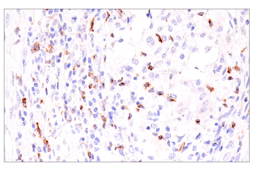 Immunohistochemistry Image 1: CTLA-4 (E2V1Z) Rabbit mAb (BSA and Azide Free)