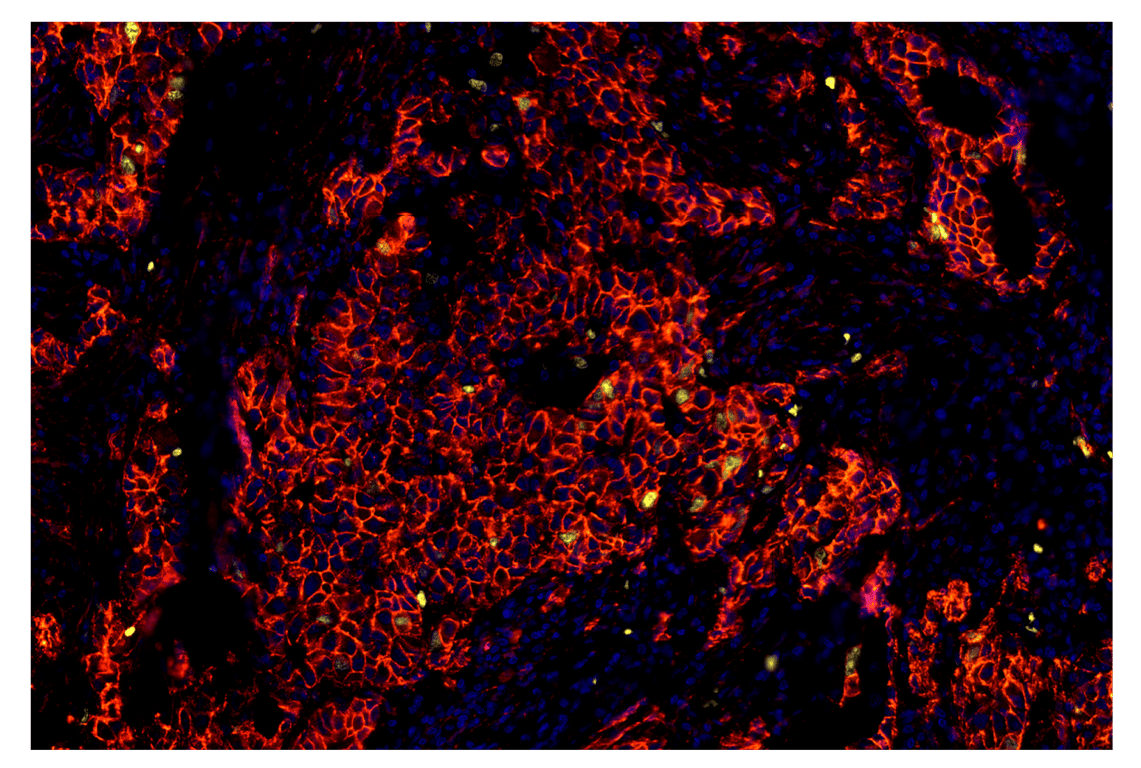 Immunohistochemistry Image 1: beta-Catenin (D10A8) & CO-0108-750 SignalStar<sup>™</sup> Oligo-Antibody Pair